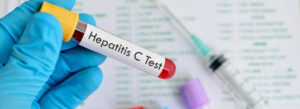 Hepatite C 2