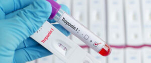 troponina