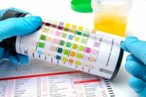 tiras-reagentes-para-analise-urinaria-tudo-o-que-você-precisa-saber-10-parametros-indavidas-produtos-hospitalares_1