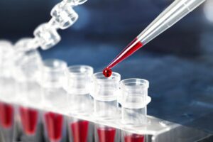 tipos-de-micropipeta-pipeta-pasteur-pipeta-graduada-sorologica-pipetar-pipetagem-3