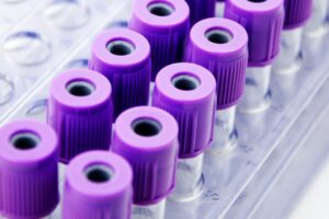 tubo-edta-para-que-servem-tipos-de-tubo-coleta-de-sangue-cores-tampas-2